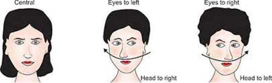 oculocephalic reflex